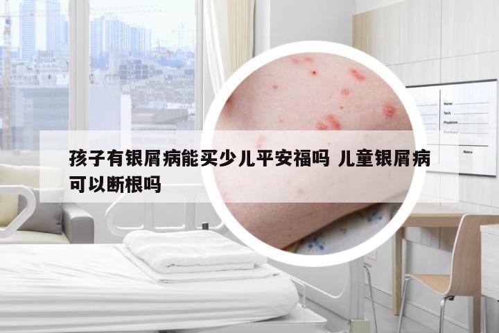 孩子有银屑病能买少儿平安福吗 儿童银屑病可以断根吗