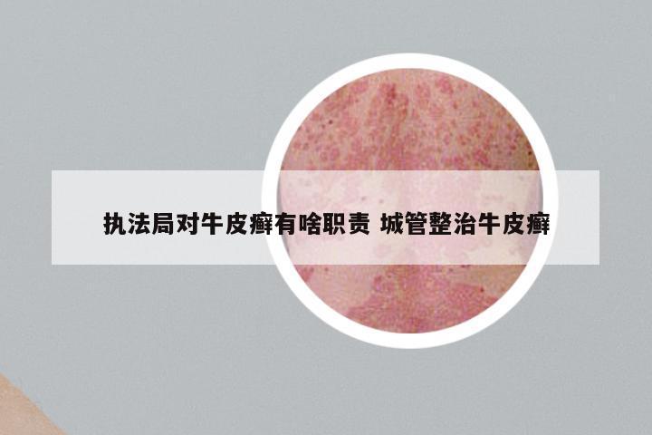 执法局对牛皮癣有啥职责 城管整治牛皮癣