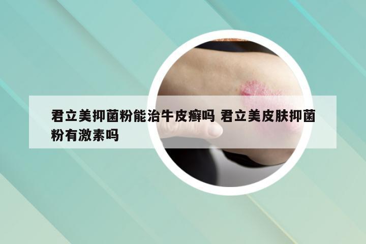 君立美抑菌粉能治牛皮癣吗 君立美皮肤抑菌粉有激素吗