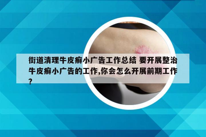 街道清理牛皮癣小广告工作总结 要开展整治牛皮癣小广告的工作,你会怎么开展前期工作?