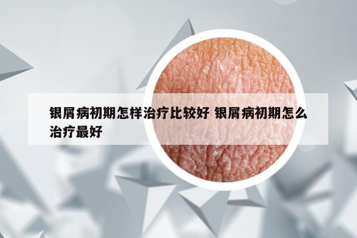 银屑病初期怎样治疗比较好 银屑病初期怎么治疗最好