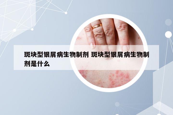 斑块型银屑病生物制剂 斑块型银屑病生物制剂是什么