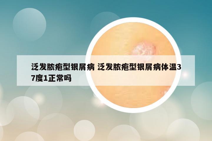 泛发脓疱型银屑病 泛发脓疱型银屑病体温37度1正常吗