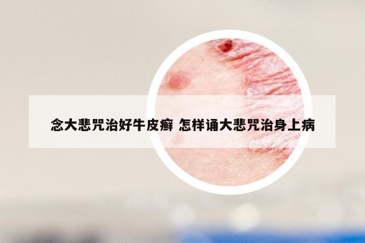 念大悲咒治好牛皮癣 怎样诵大悲咒治身上病