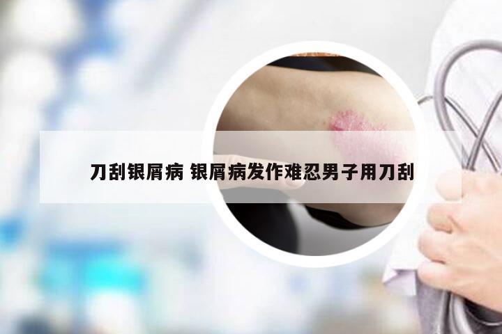 刀刮银屑病 银屑病发作难忍男子用刀刮