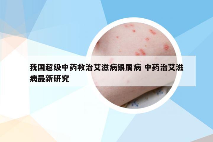 我国超级中药救治艾滋病银屑病 中药治艾滋病最新研究