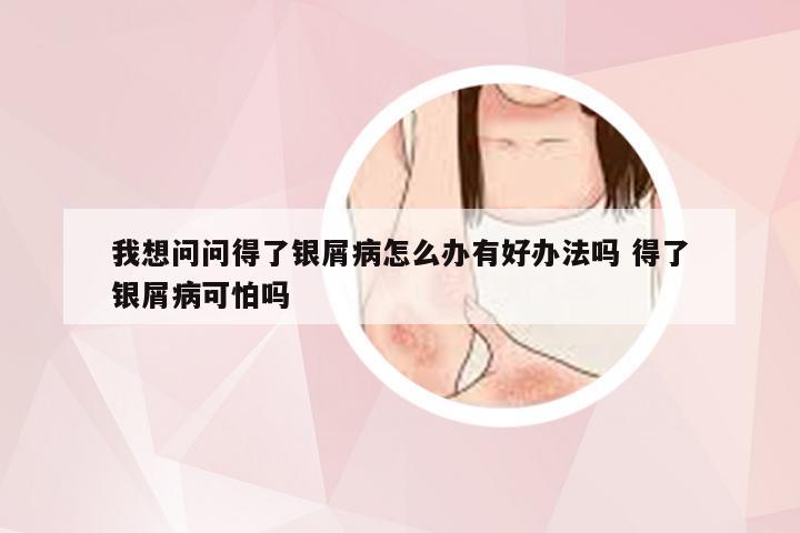 我想问问得了银屑病怎么办有好办法吗 得了银屑病可怕吗