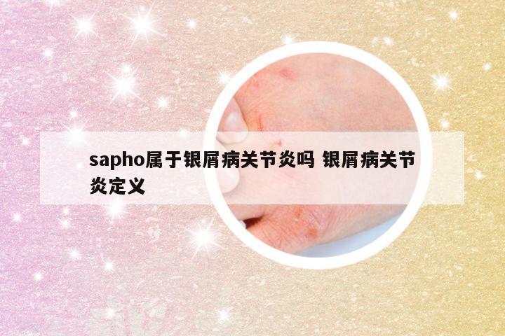 sapho属于银屑病关节炎吗 银屑病关节炎定义