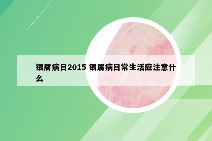 银屑病日2015 银屑病日常生活应注意什么