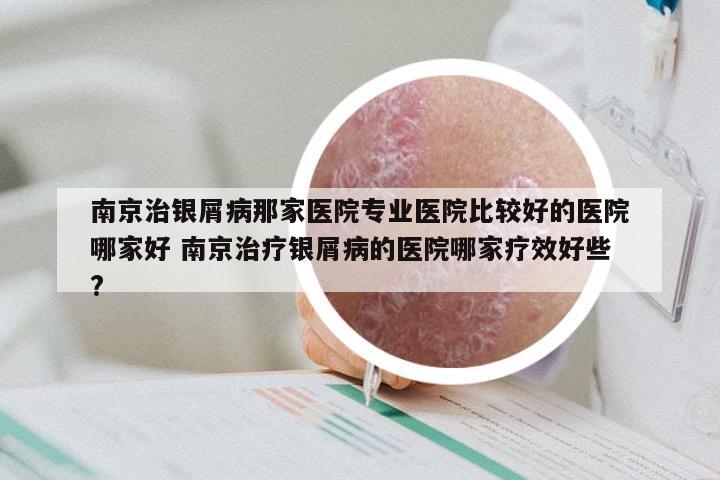 南京治银屑病那家医院专业医院比较好的医院哪家好 南京治疗银屑病的医院哪家疗效好些?