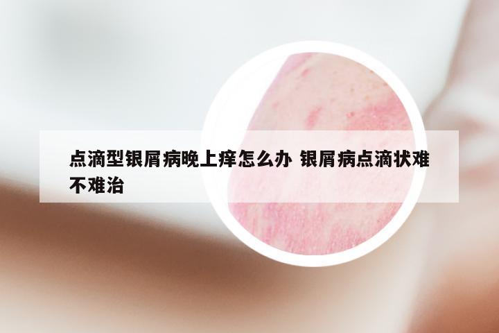 点滴型银屑病晚上痒怎么办 银屑病点滴状难不难治