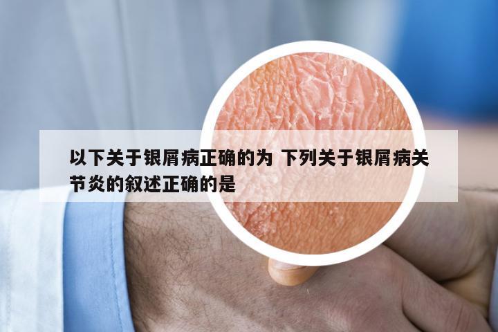 以下关于银屑病正确的为 下列关于银屑病关节炎的叙述正确的是