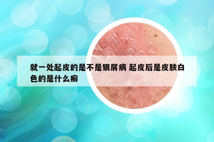 就一处起皮的是不是银屑病 起皮后是皮肤白色的是什么癣