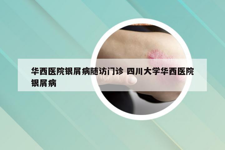 华西医院银屑病随访门诊 四川大学华西医院银屑病