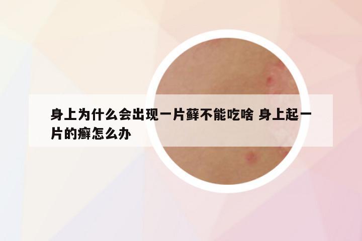 身上为什么会出现一片藓不能吃啥 身上起一片的癣怎么办