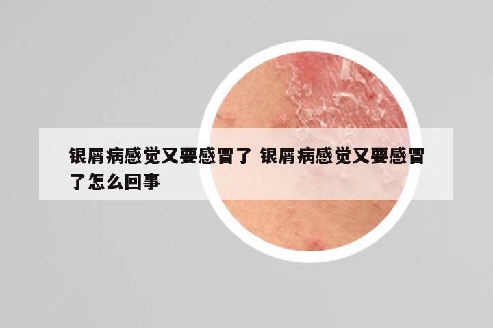 银屑病感觉又要感冒了 银屑病感觉又要感冒了怎么回事