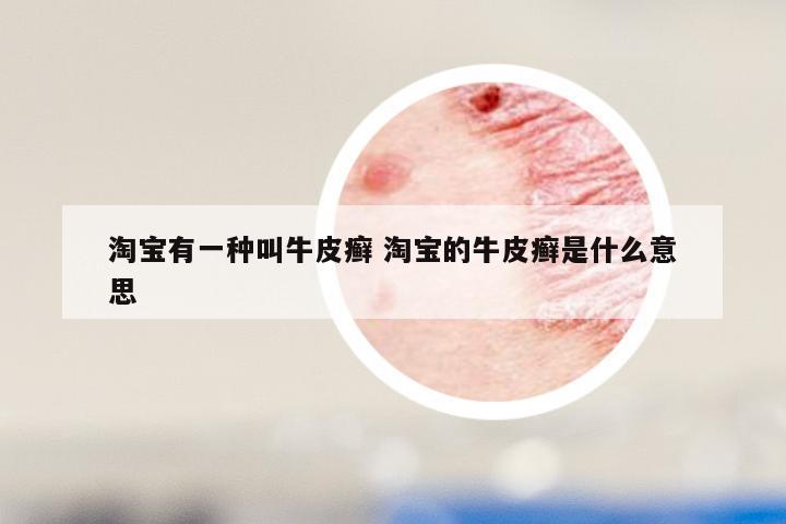 淘宝有一种叫牛皮癣 淘宝的牛皮癣是什么意思