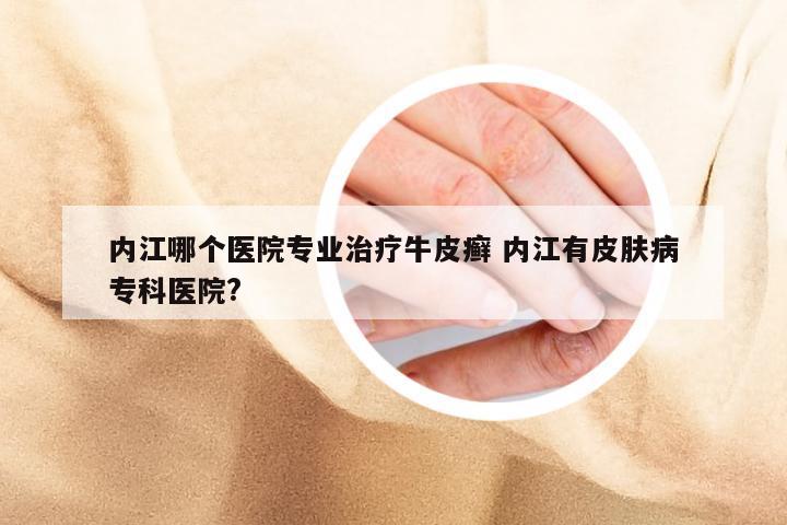 内江哪个医院专业治疗牛皮癣 内江有皮肤病专科医院?
