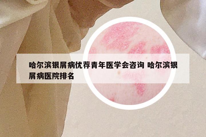 哈尔滨银屑病优荐青年医学会咨询 哈尔滨银屑病医院排名