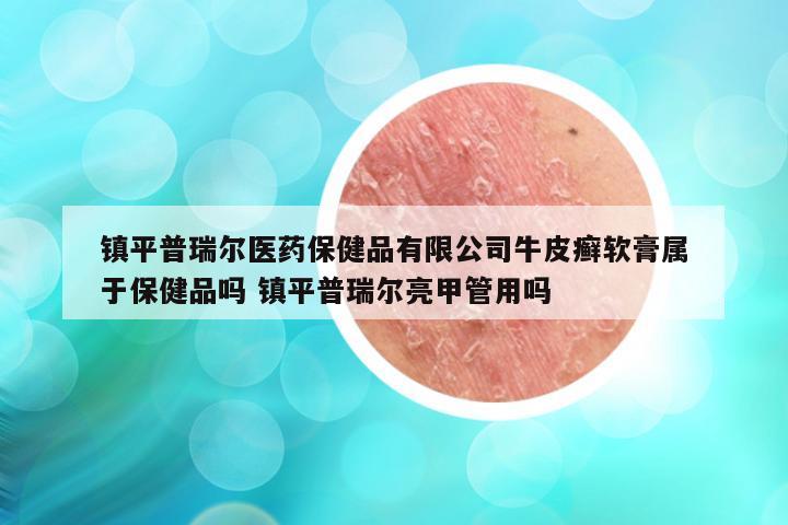 镇平普瑞尔医药保健品有限公司牛皮癣软膏属于保健品吗 镇平普瑞尔亮甲管用吗