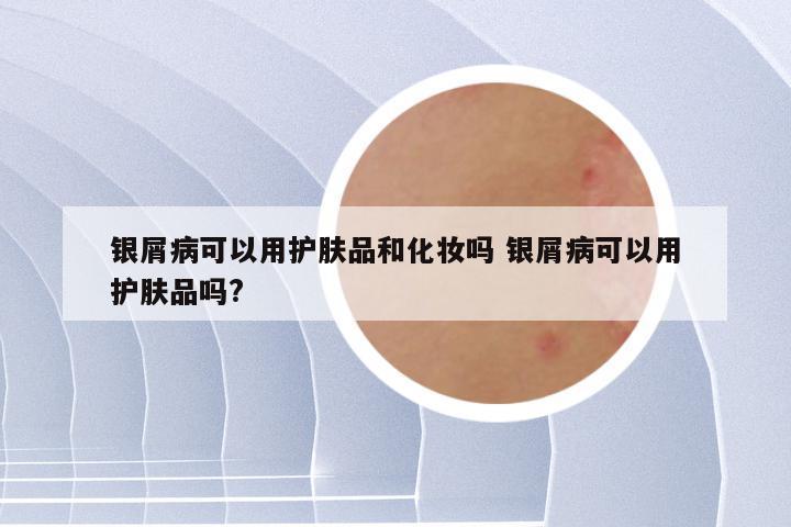 银屑病可以用护肤品和化妆吗 银屑病可以用护肤品吗?