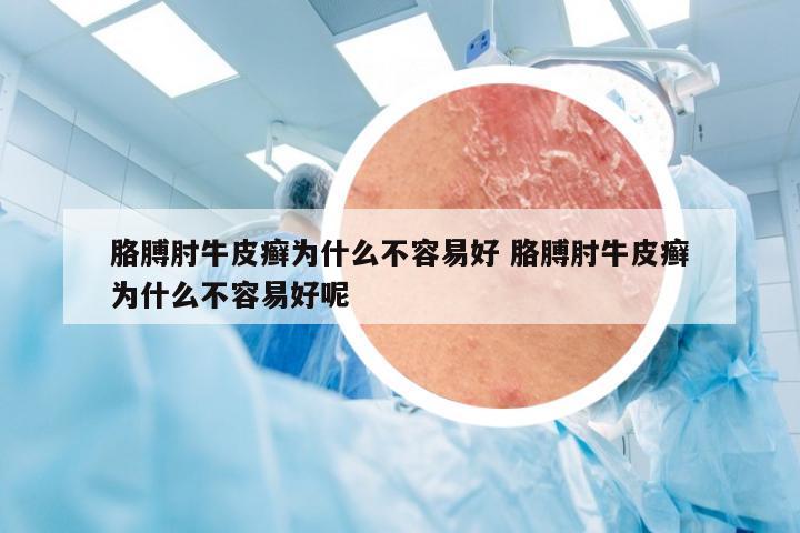 胳膊肘牛皮癣为什么不容易好 胳膊肘牛皮癣为什么不容易好呢