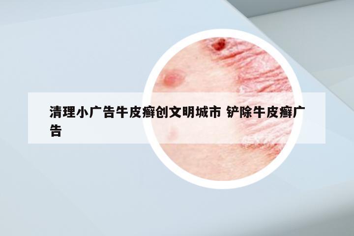 清理小广告牛皮癣创文明城市 铲除牛皮癣广告