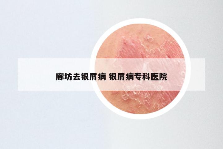 廊坊去银屑病 银屑病专科医院