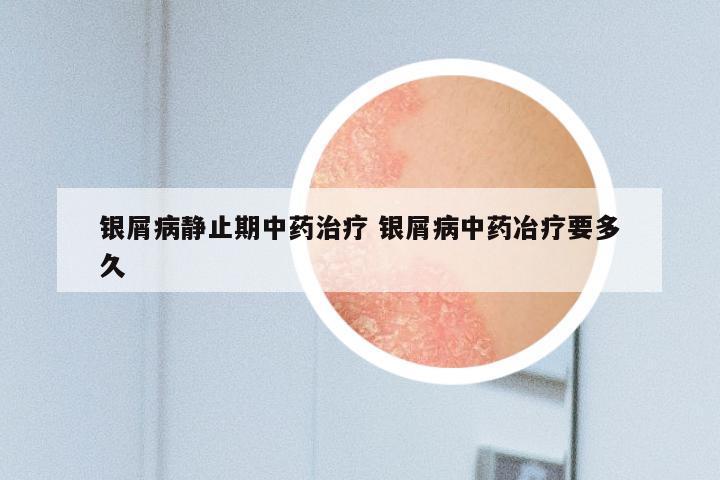 银屑病静止期中药治疗 银屑病中药冶疗要多久