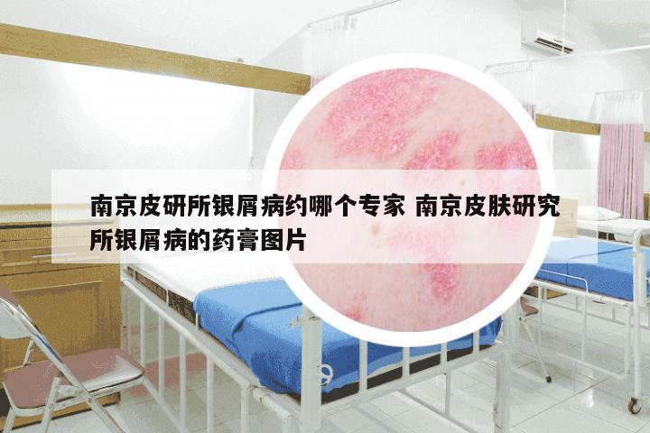 南京皮研所银屑病约哪个专家 南京皮肤研究所银屑病的药膏图片