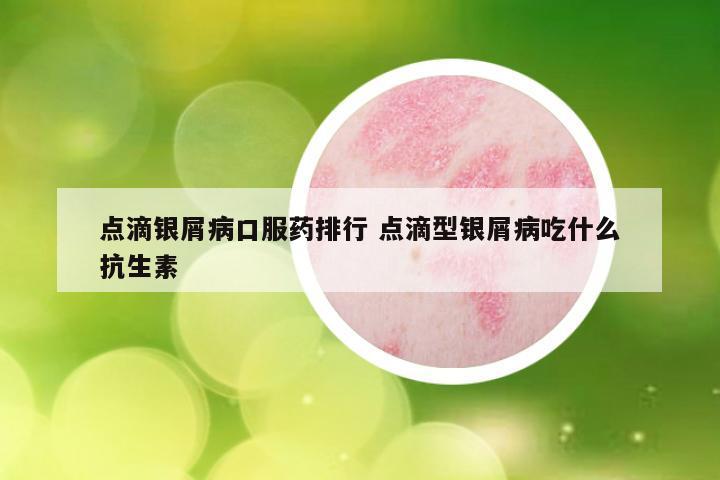 点滴银屑病口服药排行 点滴型银屑病吃什么抗生素
