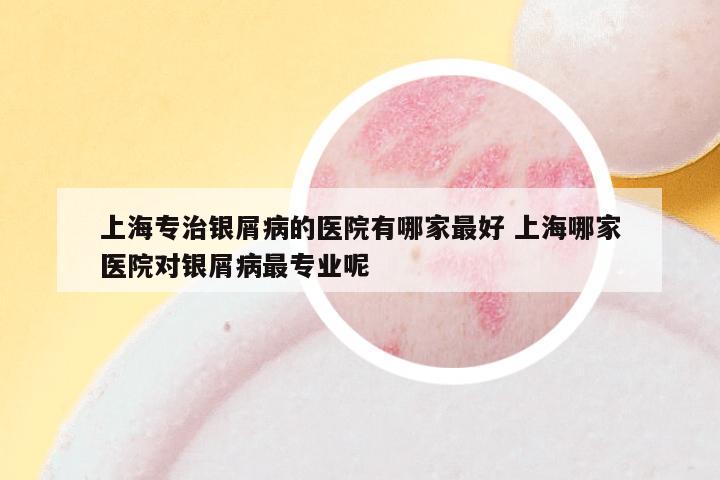 上海专治银屑病的医院有哪家最好 上海哪家医院对银屑病最专业呢