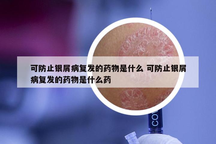 可防止银屑病复发的药物是什么 可防止银屑病复发的药物是什么药