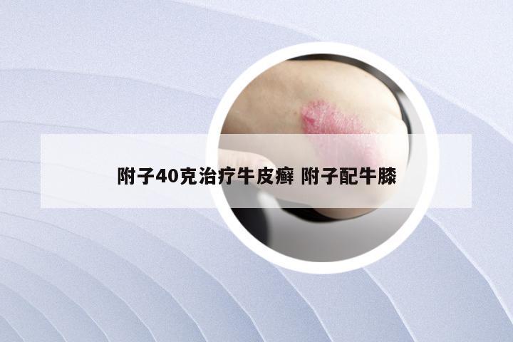 附子40克治疗牛皮癣 附子配牛膝