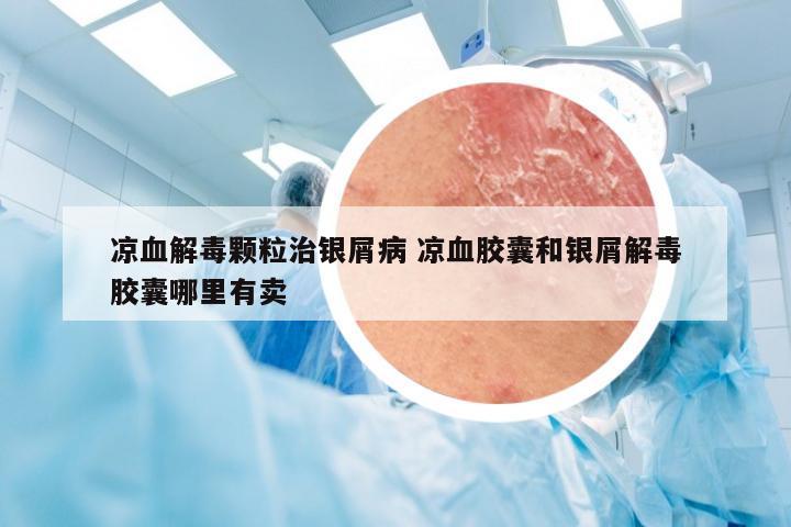 凉血解毒颗粒治银屑病 凉血胶囊和银屑解毒胶囊哪里有卖