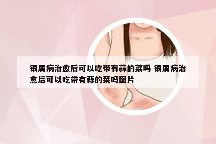 银屑病治愈后可以吃带有蒜的菜吗 银屑病治愈后可以吃带有蒜的菜吗图片