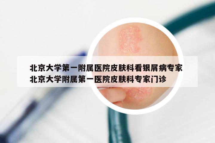 北京大学第一附属医院皮肤科看银屑病专家 北京大学附属第一医院皮肤科专家门诊