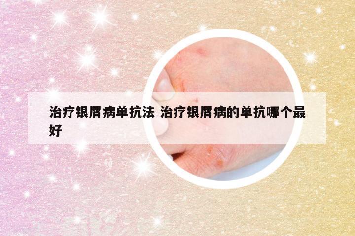 治疗银屑病单抗法 治疗银屑病的单抗哪个最好