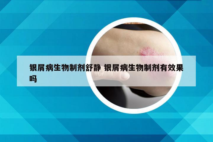 银屑病生物制剂舒静 银屑病生物制剂有效果吗