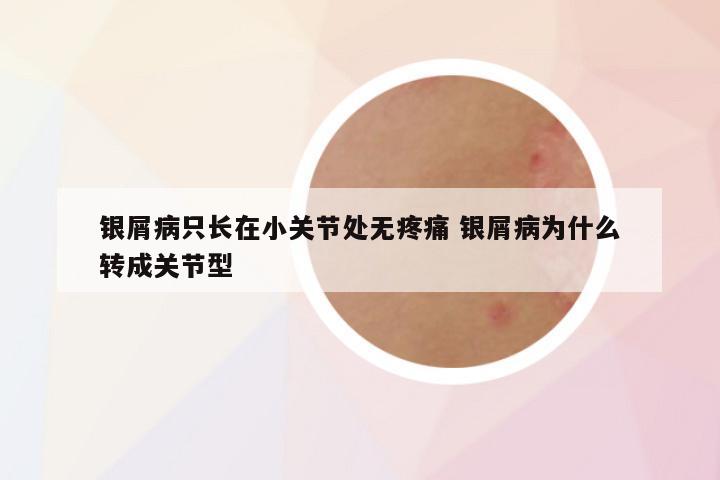 银屑病只长在小关节处无疼痛 银屑病为什么转成关节型