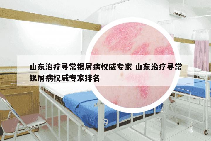山东治疗寻常银屑病权威专家 山东治疗寻常银屑病权威专家排名