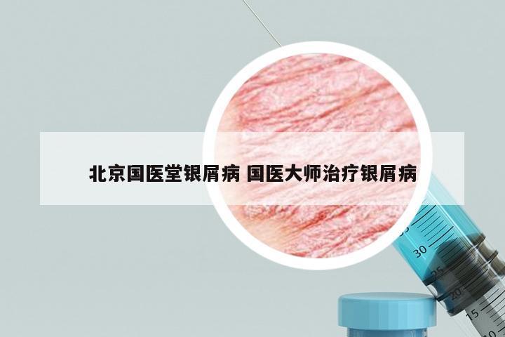 北京国医堂银屑病 国医大师治疗银屑病