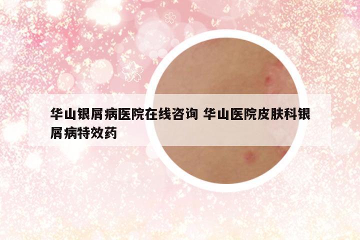 华山银屑病医院在线咨询 华山医院皮肤科银屑病特效药