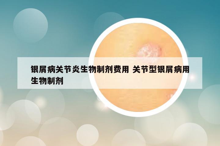 银屑病关节炎生物制剂费用 关节型银屑病用生物制剂