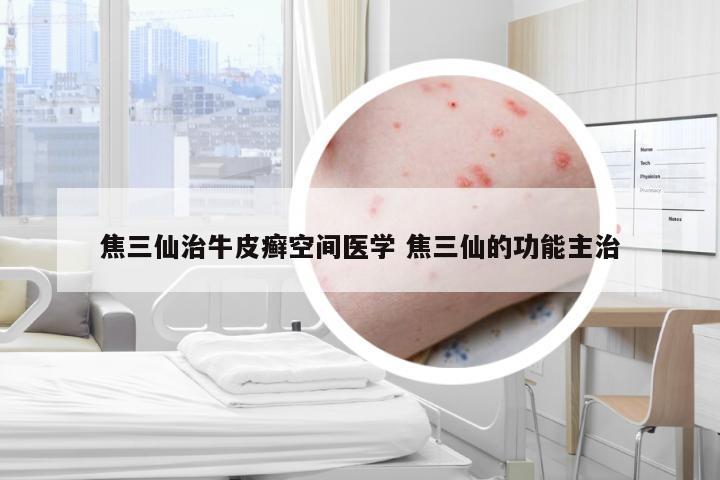 焦三仙治牛皮癣空间医学 焦三仙的功能主治