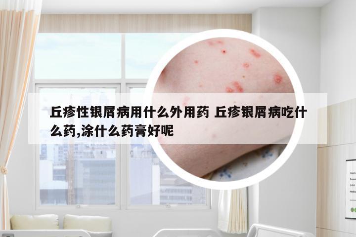 丘疹性银屑病用什么外用药 丘疹银屑病吃什么药,涂什么药膏好呢