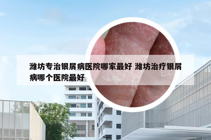 潍坊专治银屑病医院哪家最好 潍坊治疗银屑病哪个医院最好
