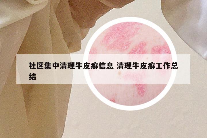 社区集中清理牛皮癣信息 清理牛皮癣工作总结