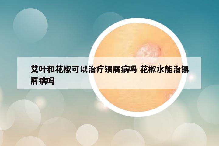 艾叶和花椒可以治疗银屑病吗 花椒水能治银屑病吗