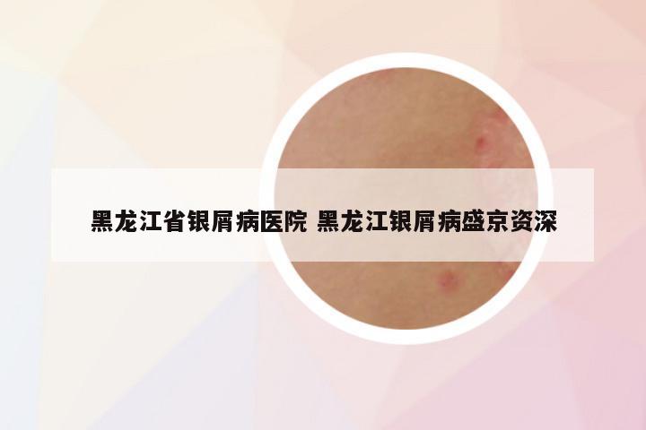 黑龙江省银屑病医院 黑龙江银屑病盛京资深